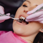 Zahnfleischtaschen – Bedrohung für die Zahnfleischgesundheit