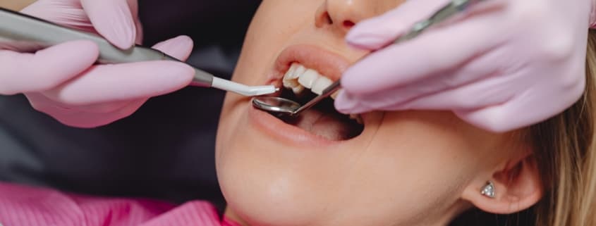 Zahnfleischtaschen – Bedrohung für die Zahnfleischgesundheit
